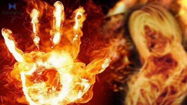ژنێک لەلایەن هاوسەرەکەیەوە سوتێندرا