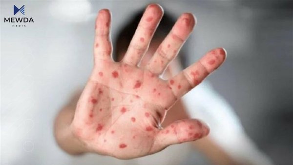 ئاوڵهى مهیمون گهیشته وڵاتی سعودیە