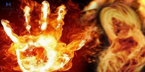 ژنێک بەهۆکارێکی نادیار سوتا