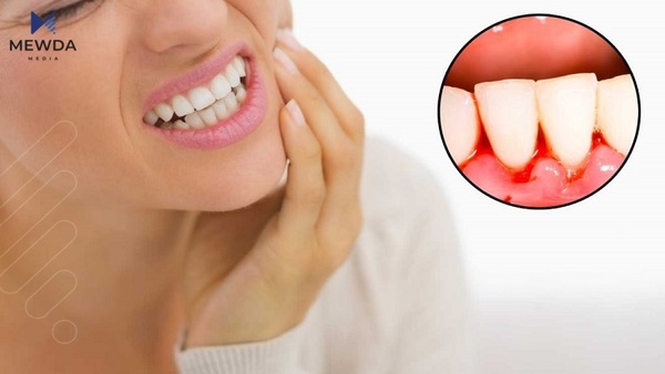 ئایا پوك و ددانەكانت بێزاریان كردویت؟