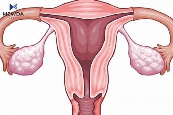 هۆکارەکانی نەزۆکی لای ژن و پیاو